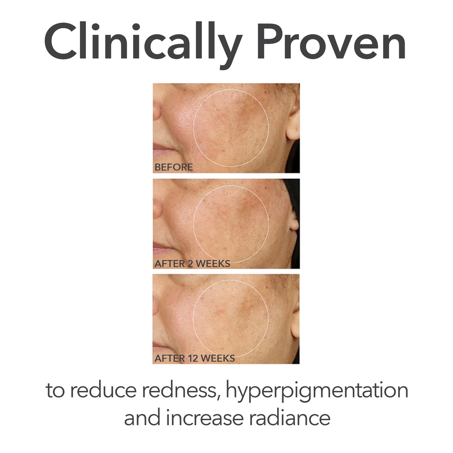 Alpha Beta® Universal Daily Peel