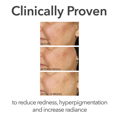 Alpha Beta® Universal Daily Peel