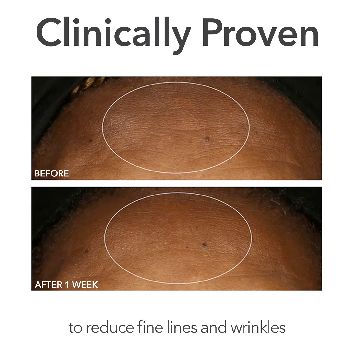 Alpha Beta® Universal Daily Peel