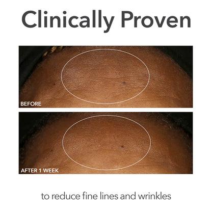 Alpha Beta® Universal Daily Peel