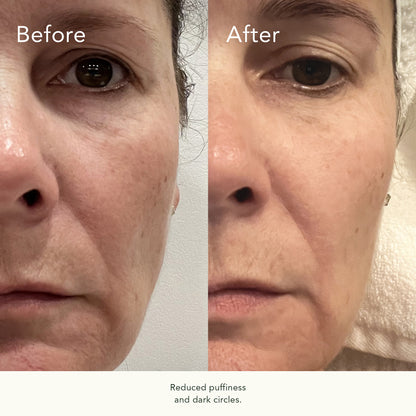 Rose Hip Intense Recovery Eye Serum