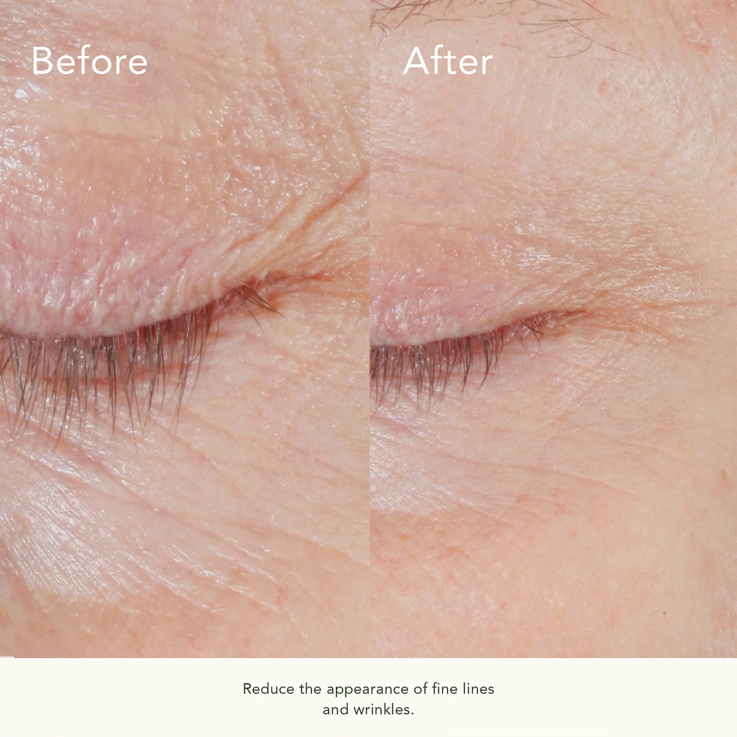 Form Control Marine Collagen Gel