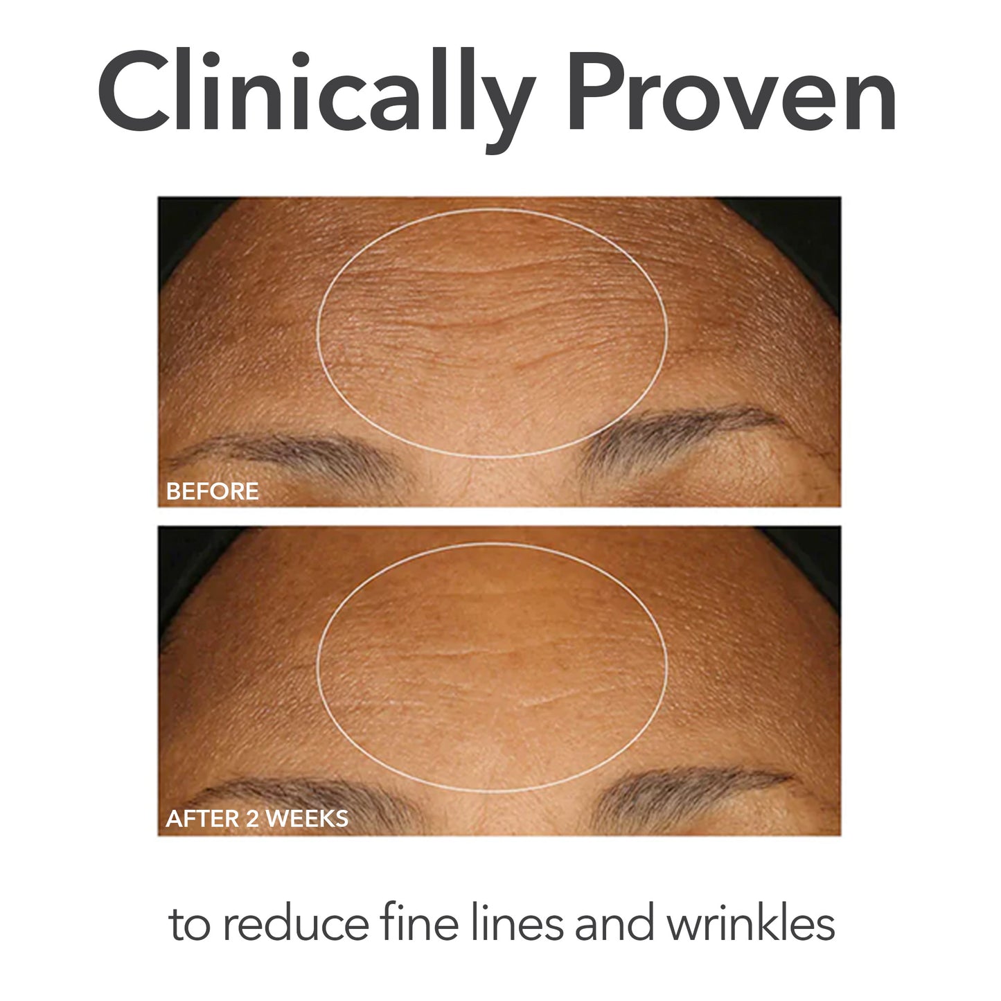 Alpha Beta Peel Extra Strength