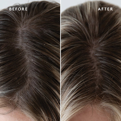 Refresh Topical Scalp Supplement