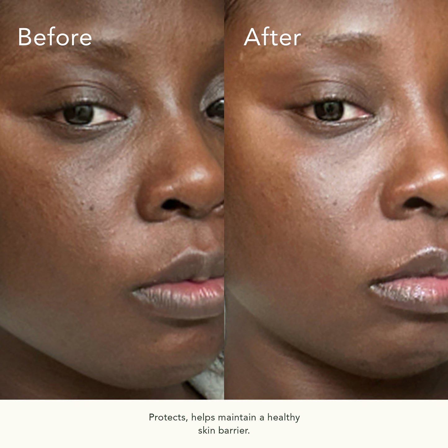 KB5 Calming Gel Cleanser