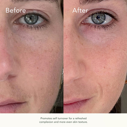 Retin-C Treatment Complex