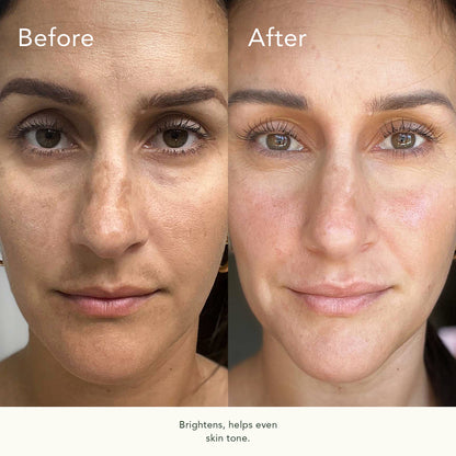 Biocell Correcting Serum