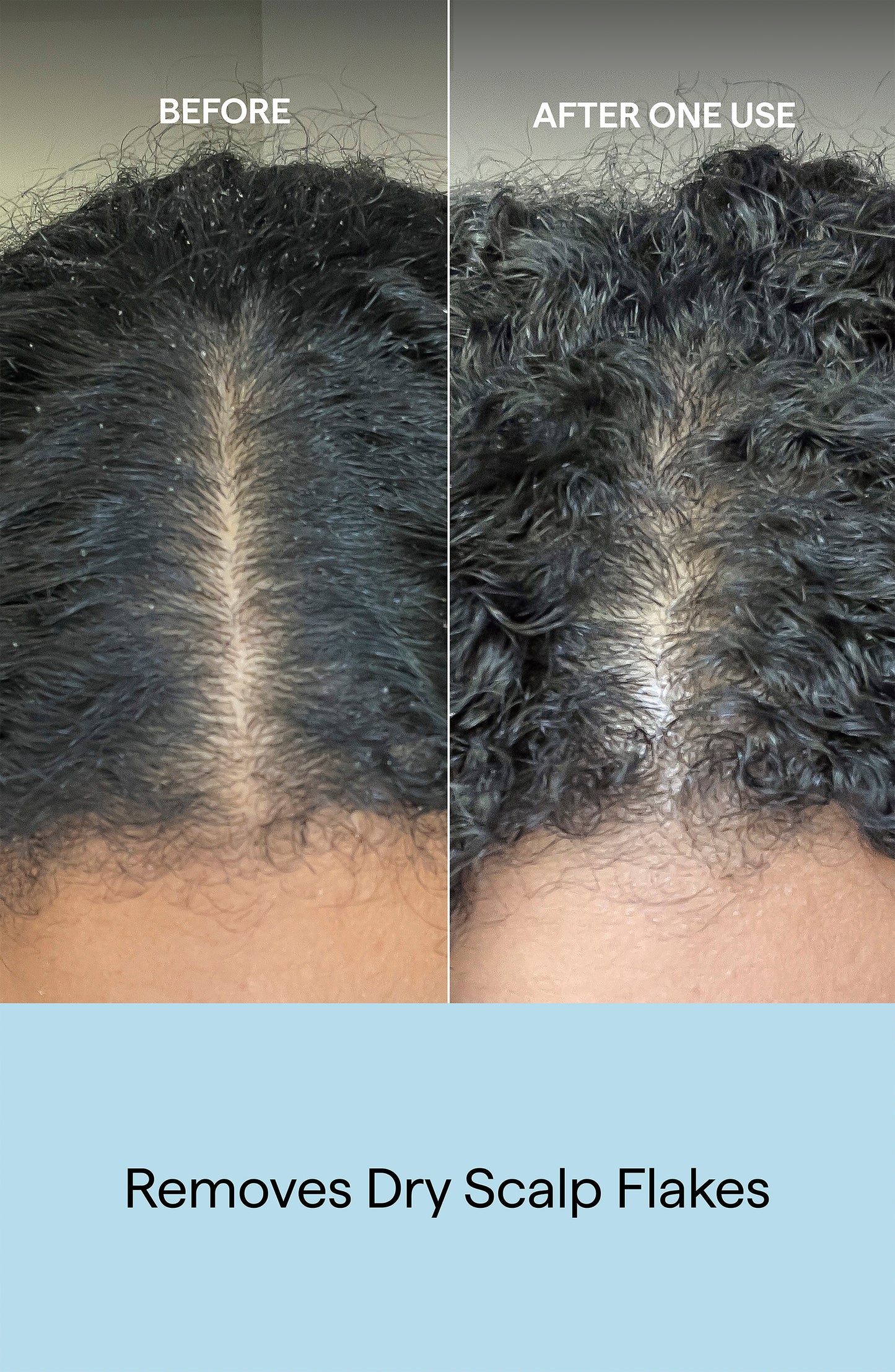 Scalp Revival Charcoal + Coconut Oil Micro-Exfoliating Shampoo