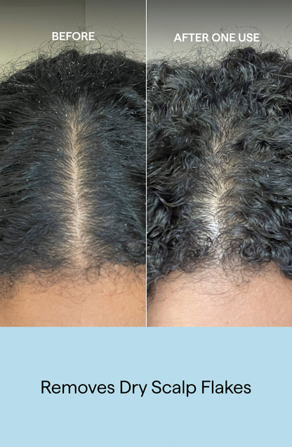 Scalp Revival Charcoal + Coconut Oil Micro-Exfoliating Shampoo