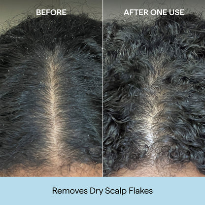 Scalp Revival Charcoal + Coconut Oil Micro-Exfoliating Shampoo