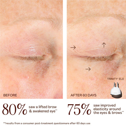 Eye And Lip Attachment