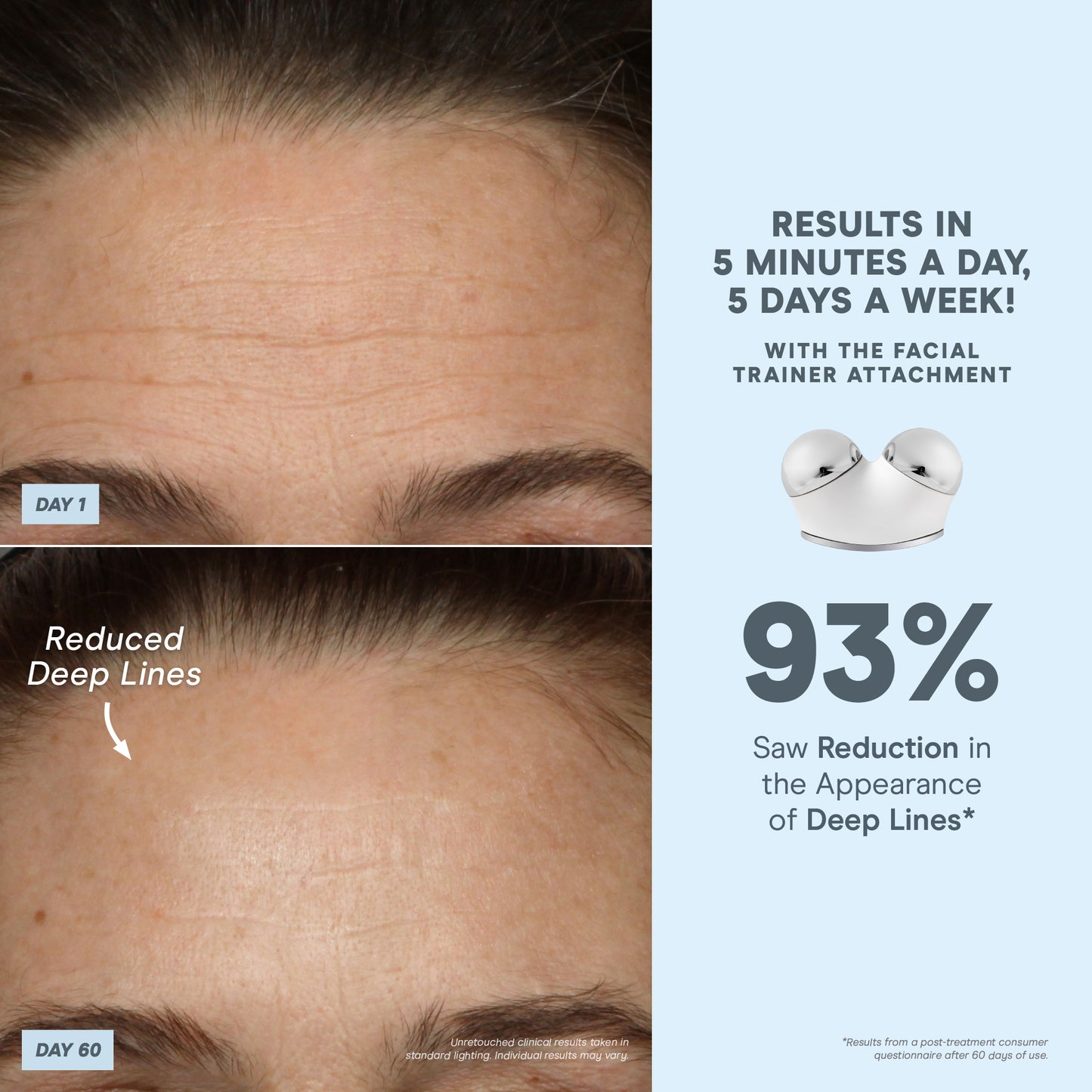 TrinityPlus All In One Kit