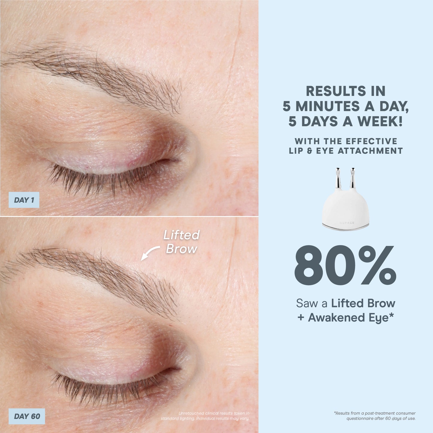 TrinityPlus All In One Kit