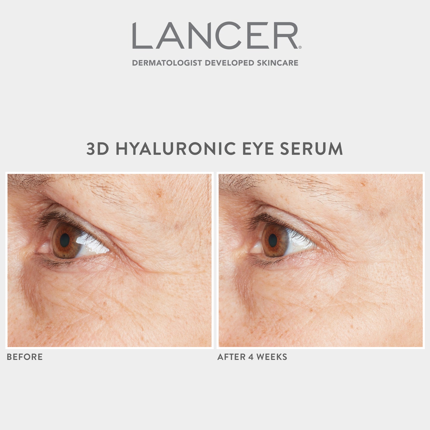 3D Hyaluronic Eye Serum