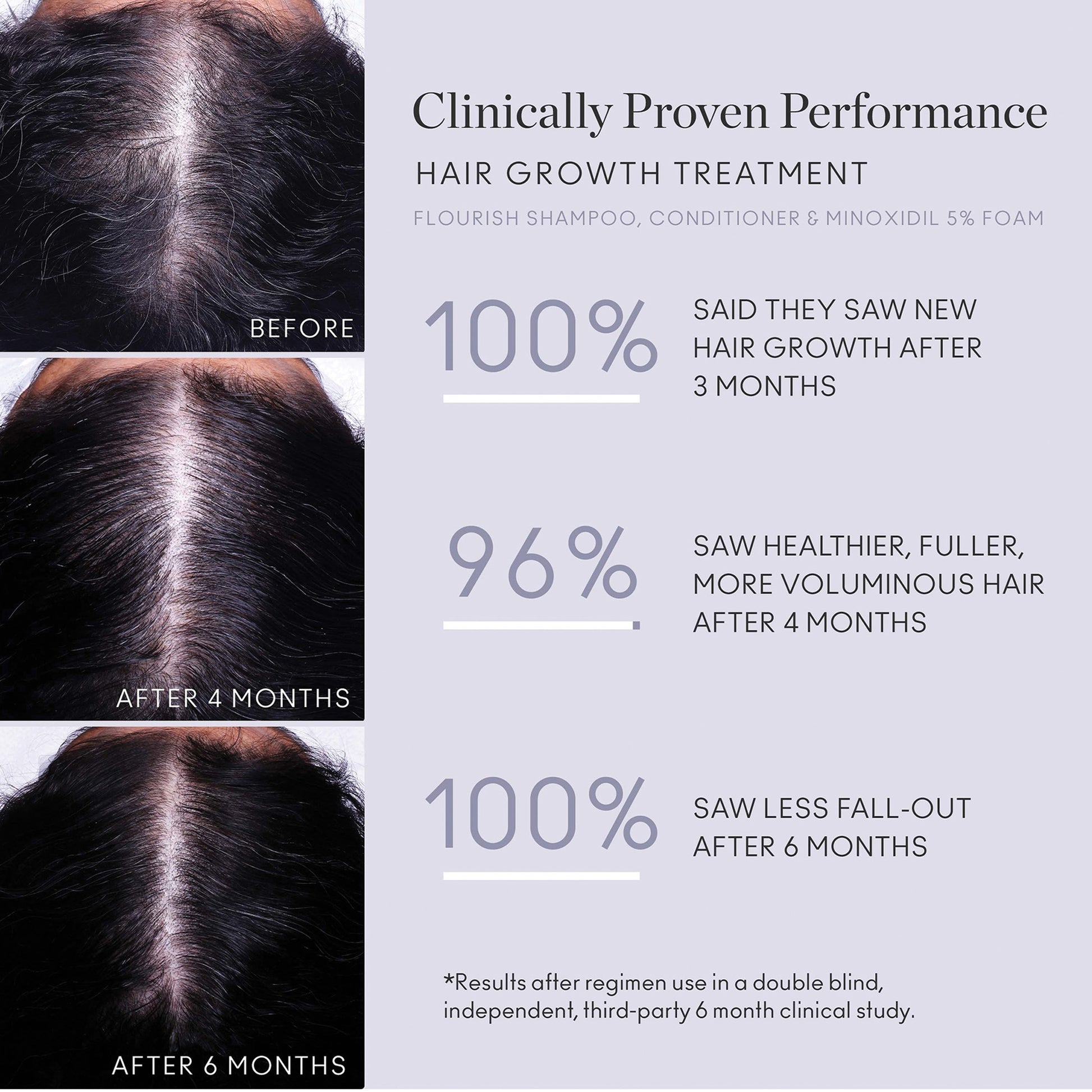 Flourish Nightly Intensive Hair Growth Treatment