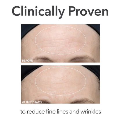 Alpha Beta Ultra Gentle Peel Pads