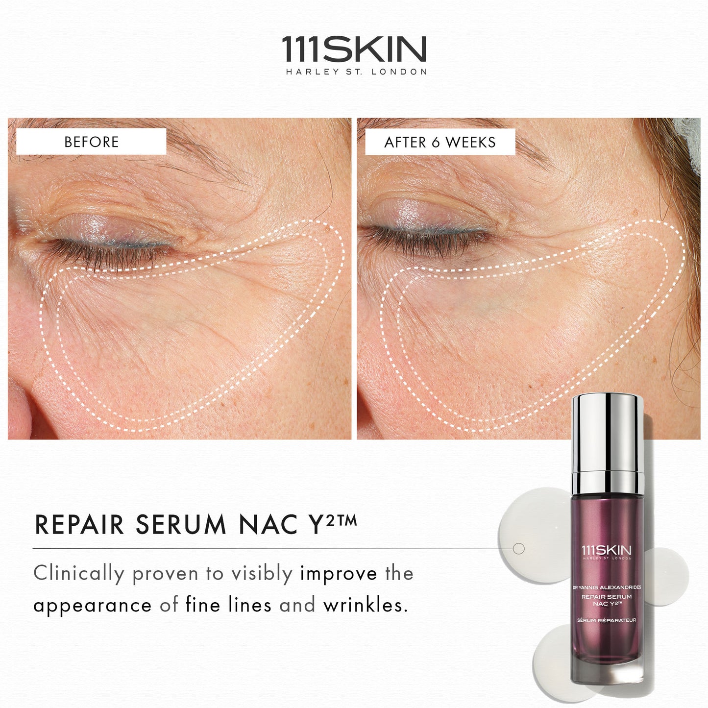 Repair Serum Nac Y2