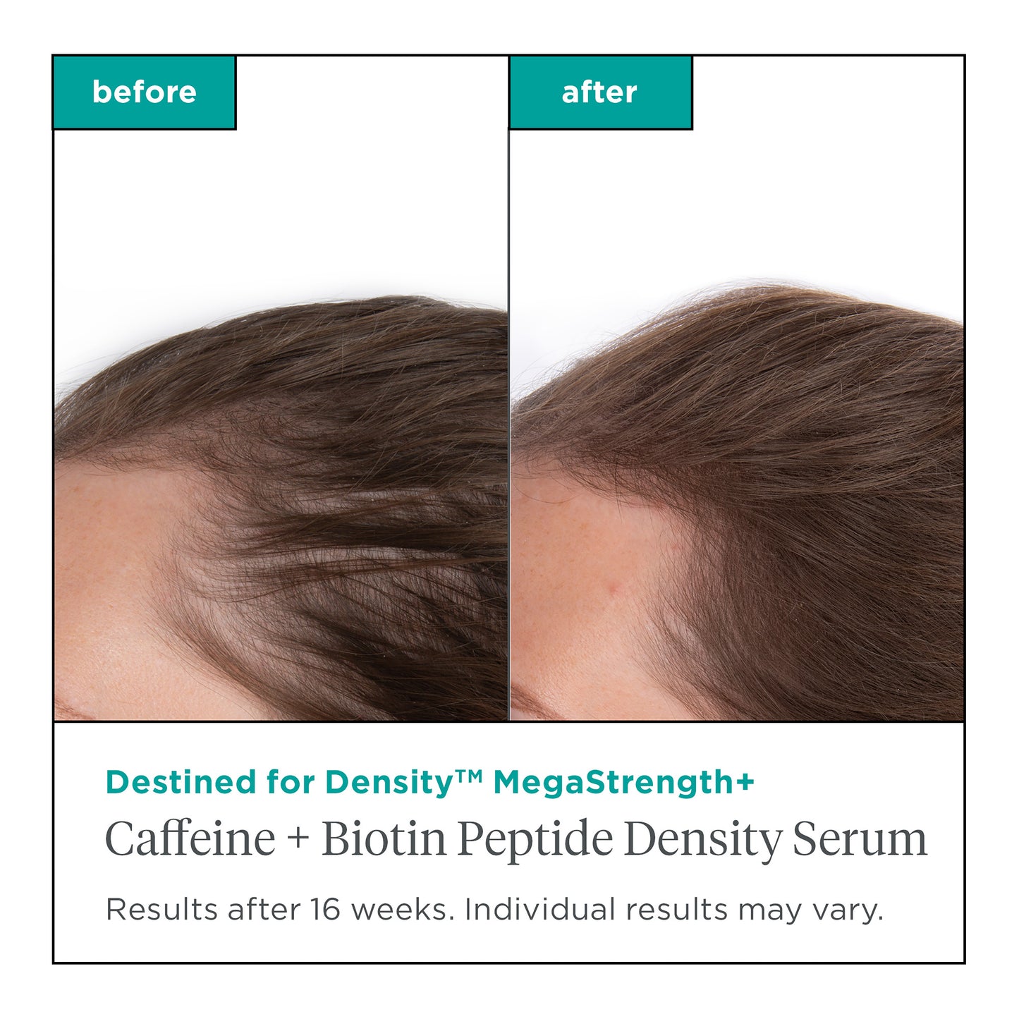 Density Serum