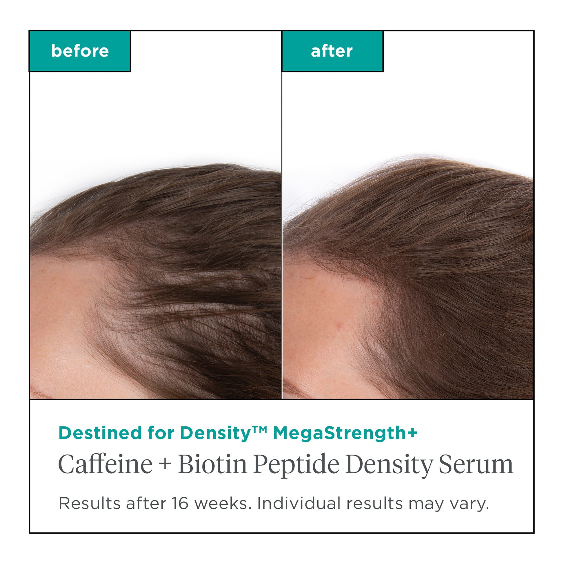 Density Serum