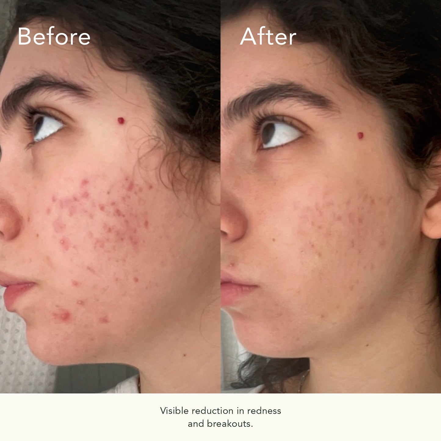 Vitabiome Active Skin Optimizer
