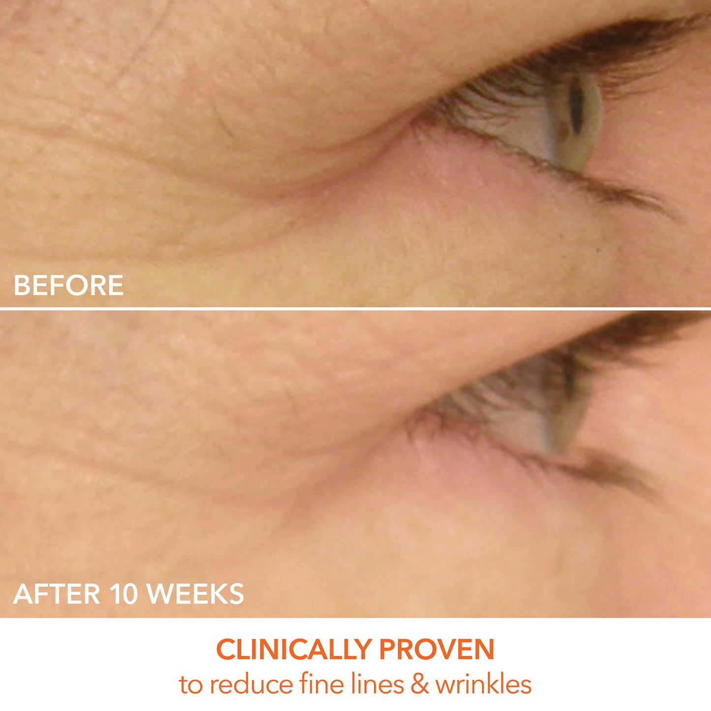 DRx SpectraLite™ EyeCare Max Pro LED Device