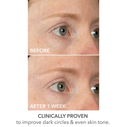 DermInfusions™ Lift + Repair Eye Mask