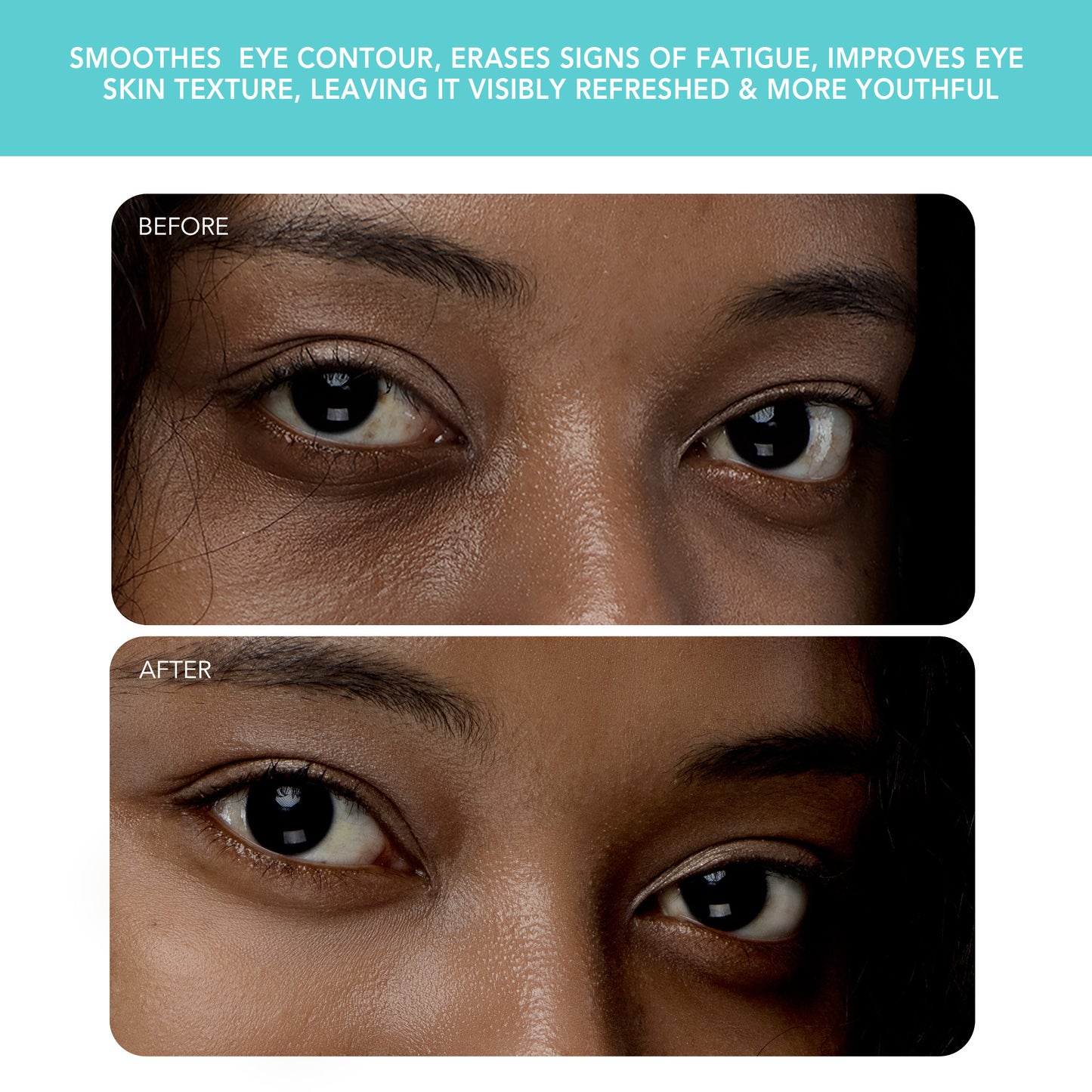 Iris 2 Eye Massager Mint