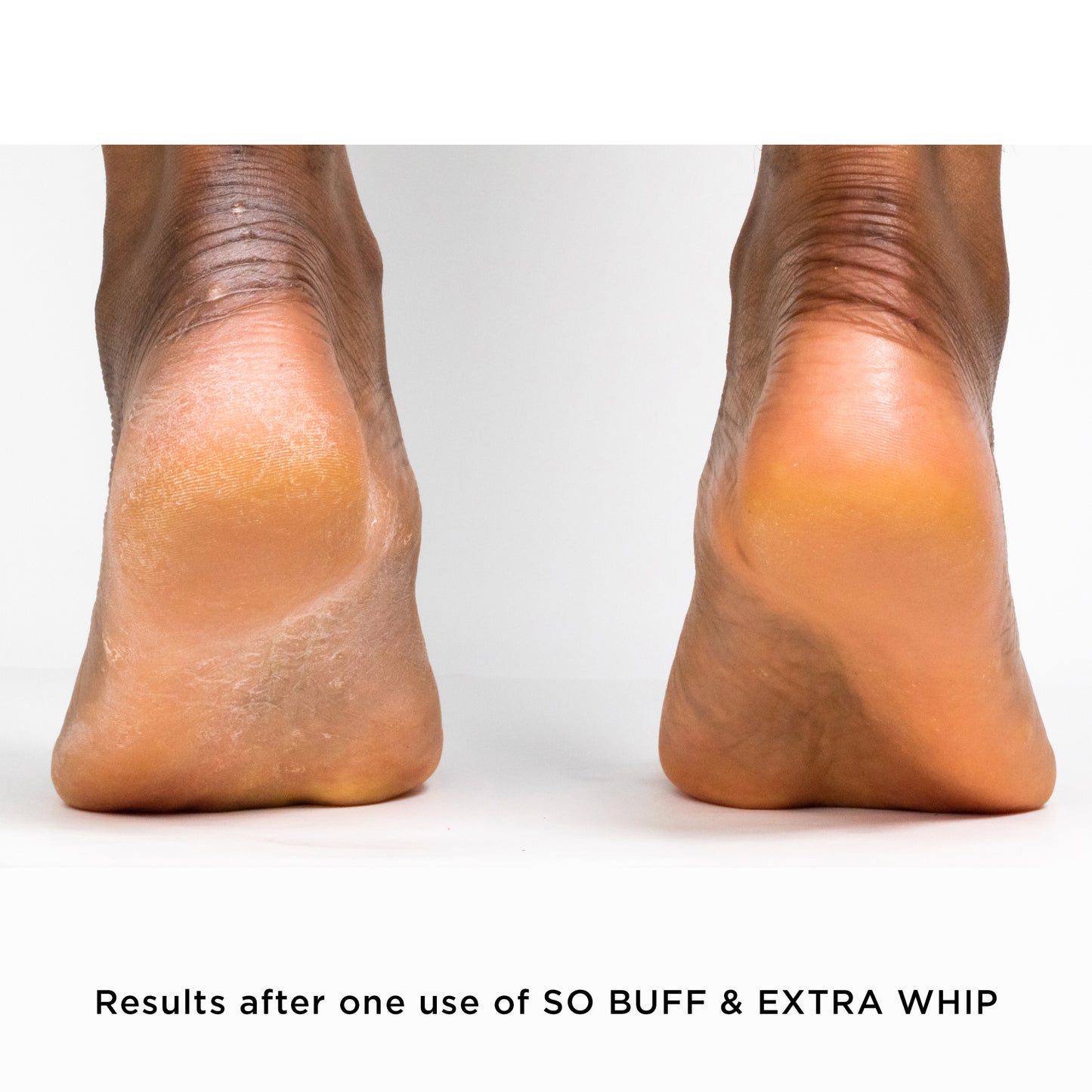 Extra Whip Hand & Foot Treatment with Shea Butter