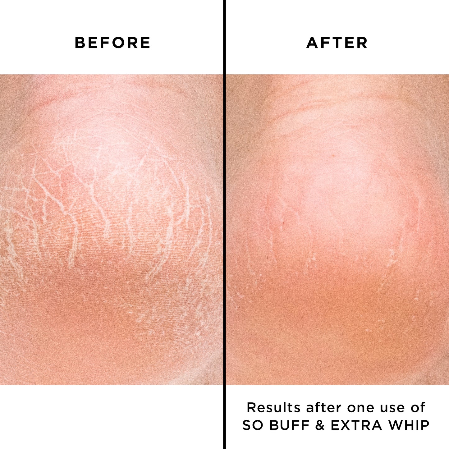 Extra Whip Hand & Foot Treatment with Shea Butter