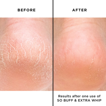 Extra Whip Hand & Foot Treatment with Shea Butter