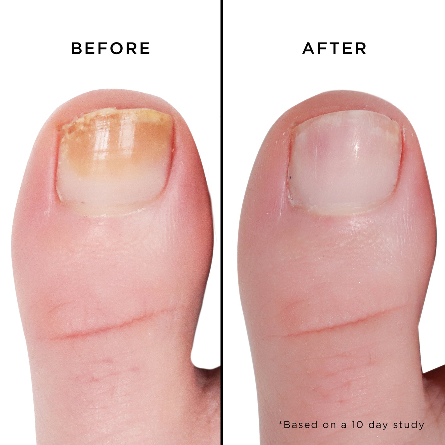 Nail Brightening Treatment