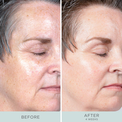 Ceretin Boost Age Defying Retinol Serum