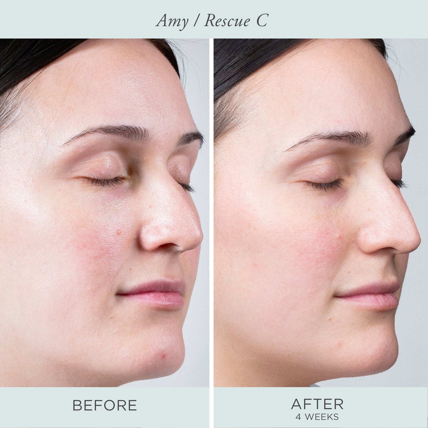 Rescue C Brightening Eye Cream