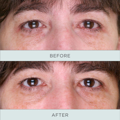 Tone Up Niacinamide Firming Eye Serum