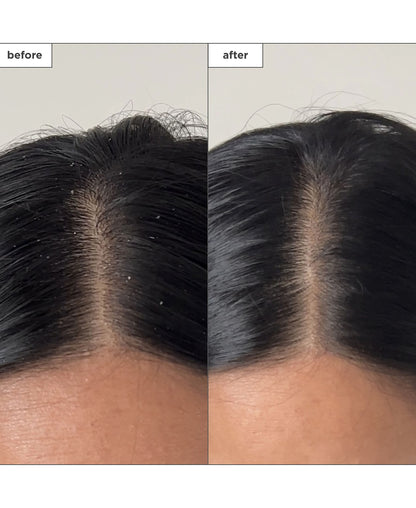 Scalp Revival Charcoal + Tea Tree Buildup Dtx Spray