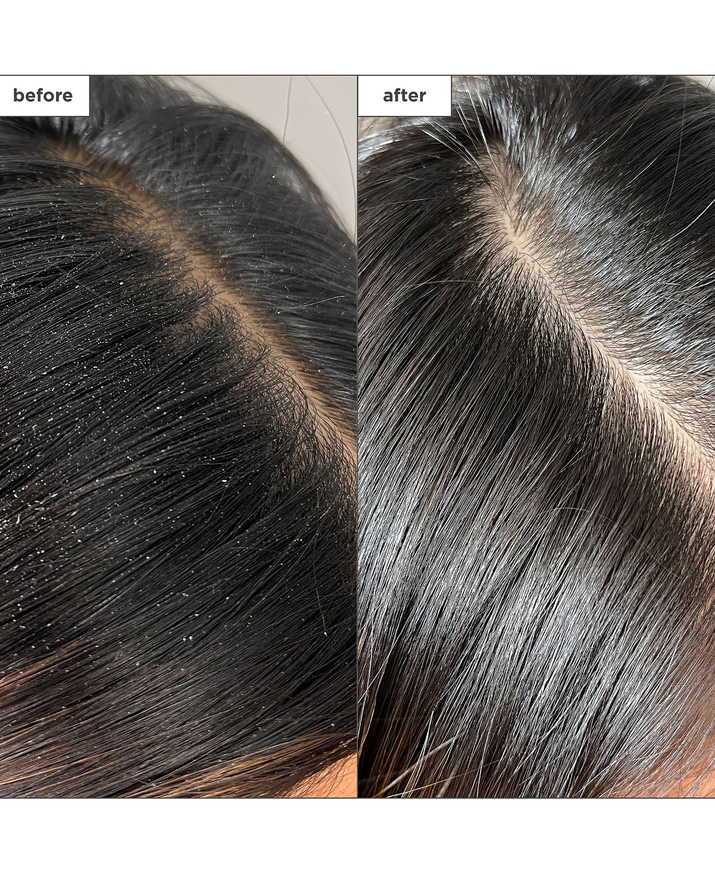 Scalp Revival Charcoal + Tea Tree Buildup Dtx Spray