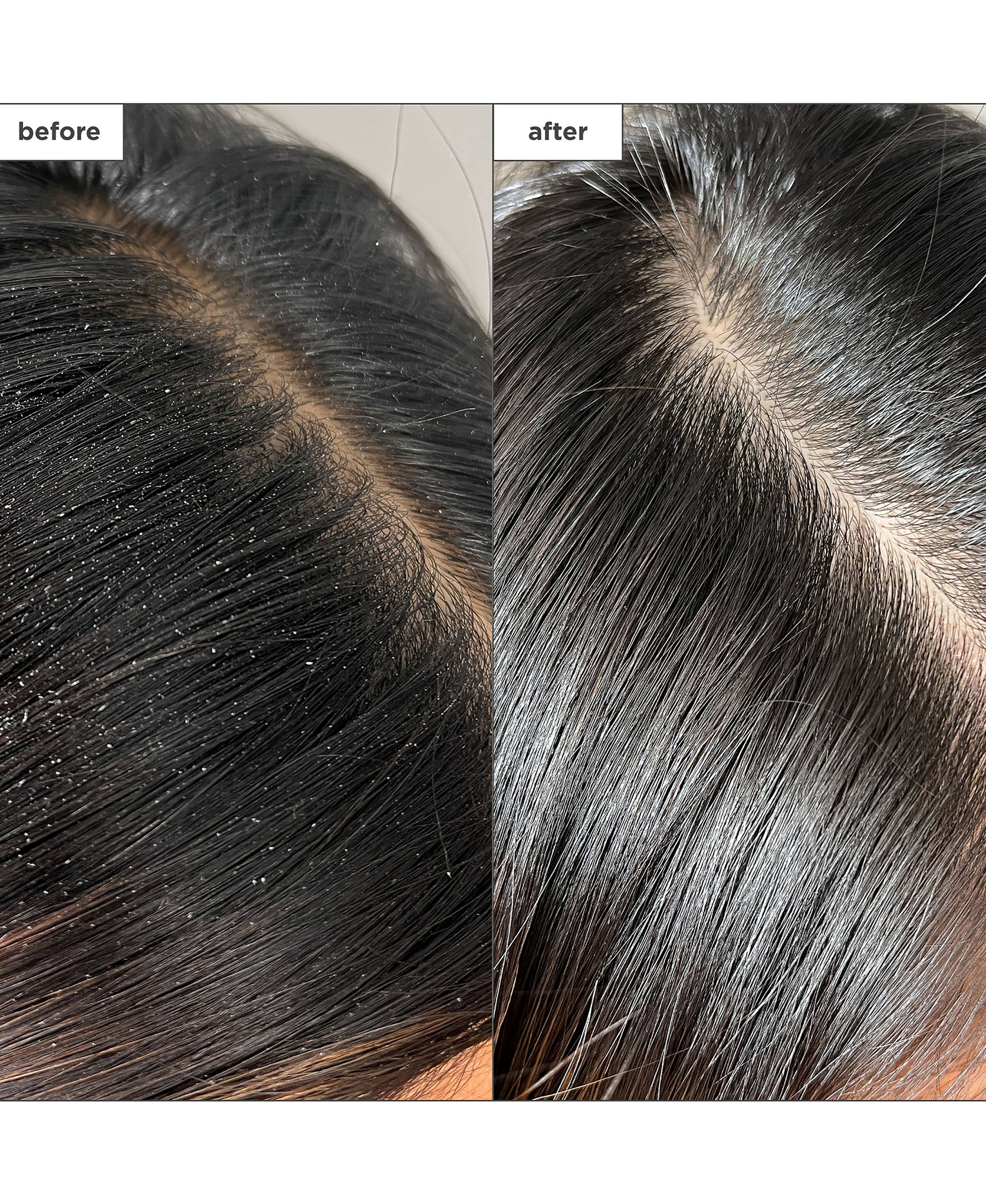 Scalp Revival Charcoal + Tea Tree Buildup Dtx Spray