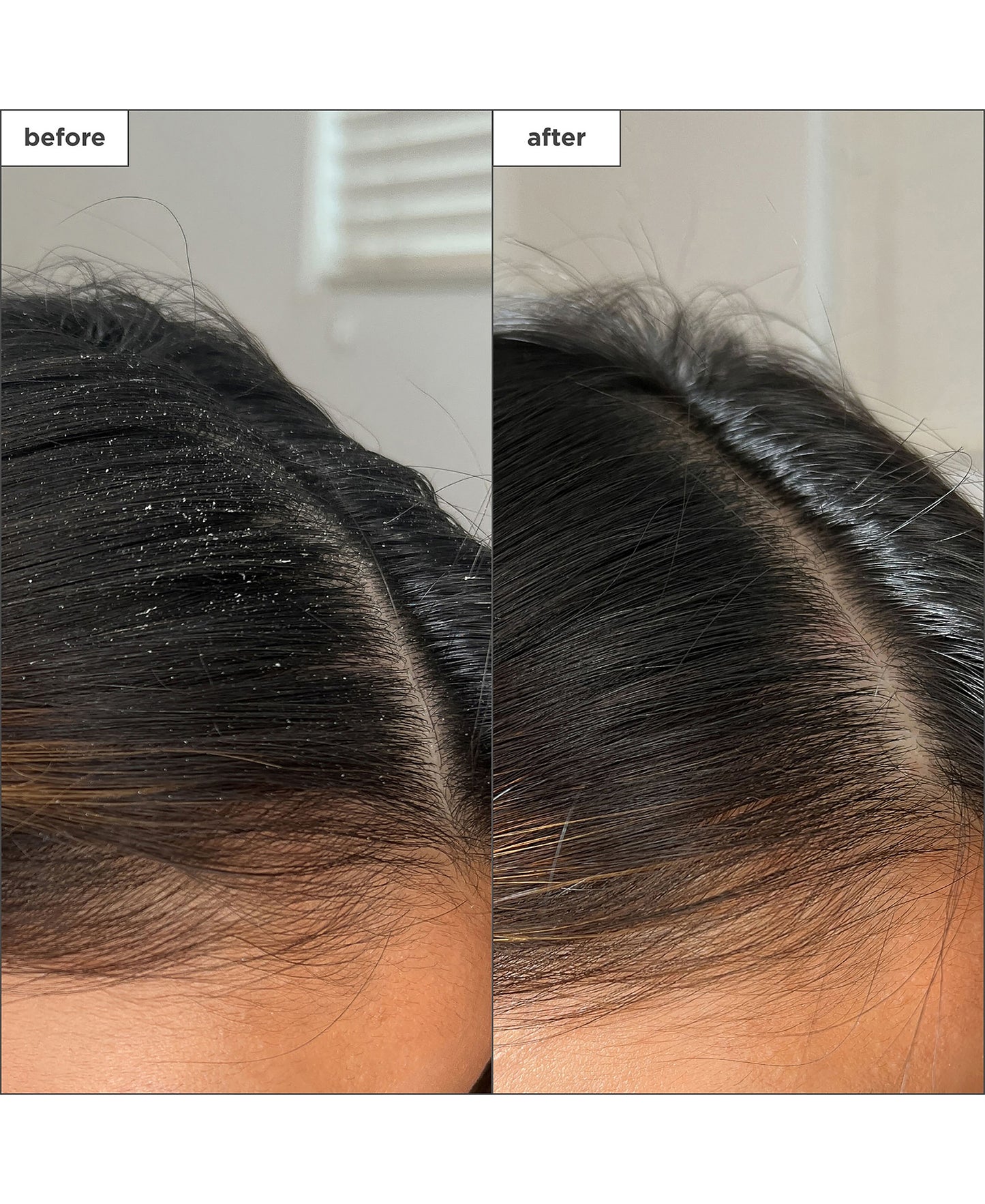 Scalp Revival Charcoal + Tea Tree Buildup Dtx Spray
