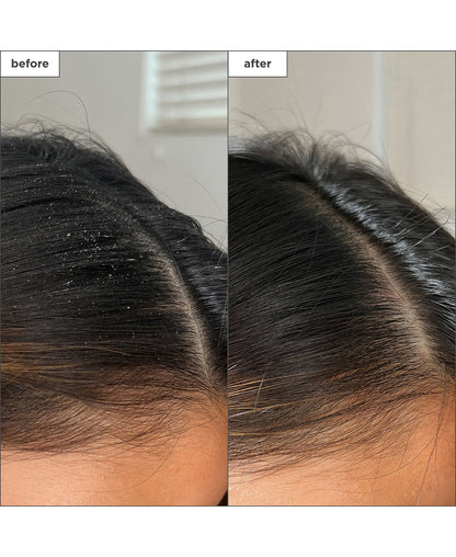 Scalp Revival Charcoal + Tea Tree Buildup Dtx Spray