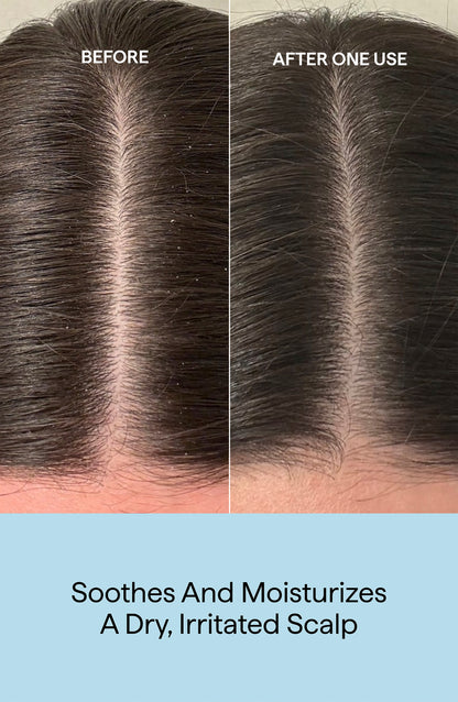 Scalp Revival Rosemary Pre-wash Oil