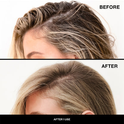 First Class Charcoal Detox Dry Shampoo