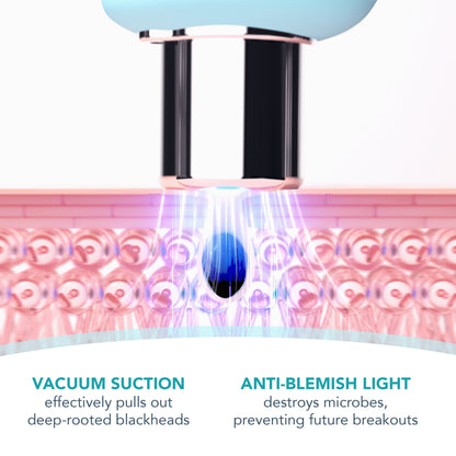 Kiwi Blackhead Remover Pore Vacuum