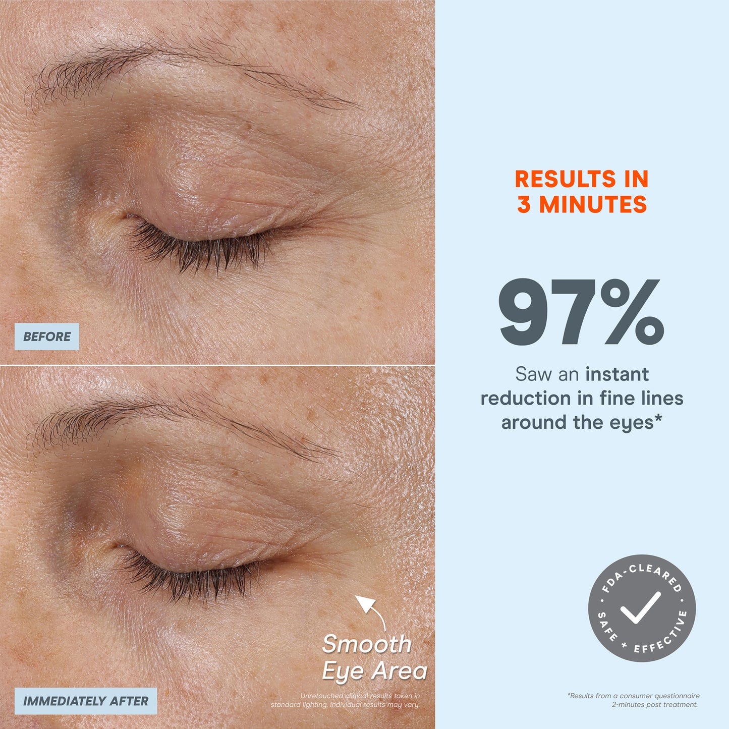 Fix Plus Starter Kit