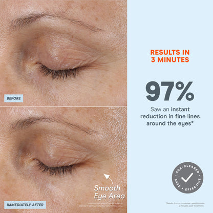 Fix Plus Starter Kit