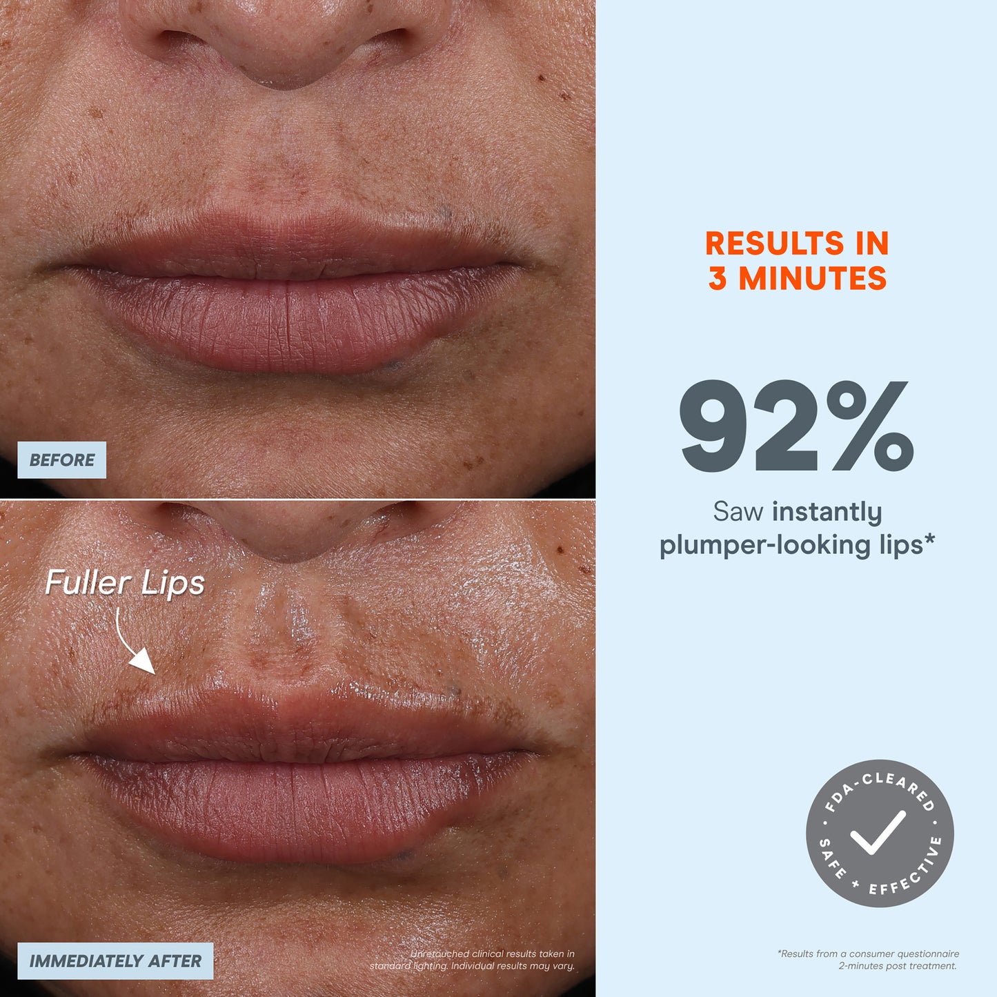 Fix Plus Starter Kit