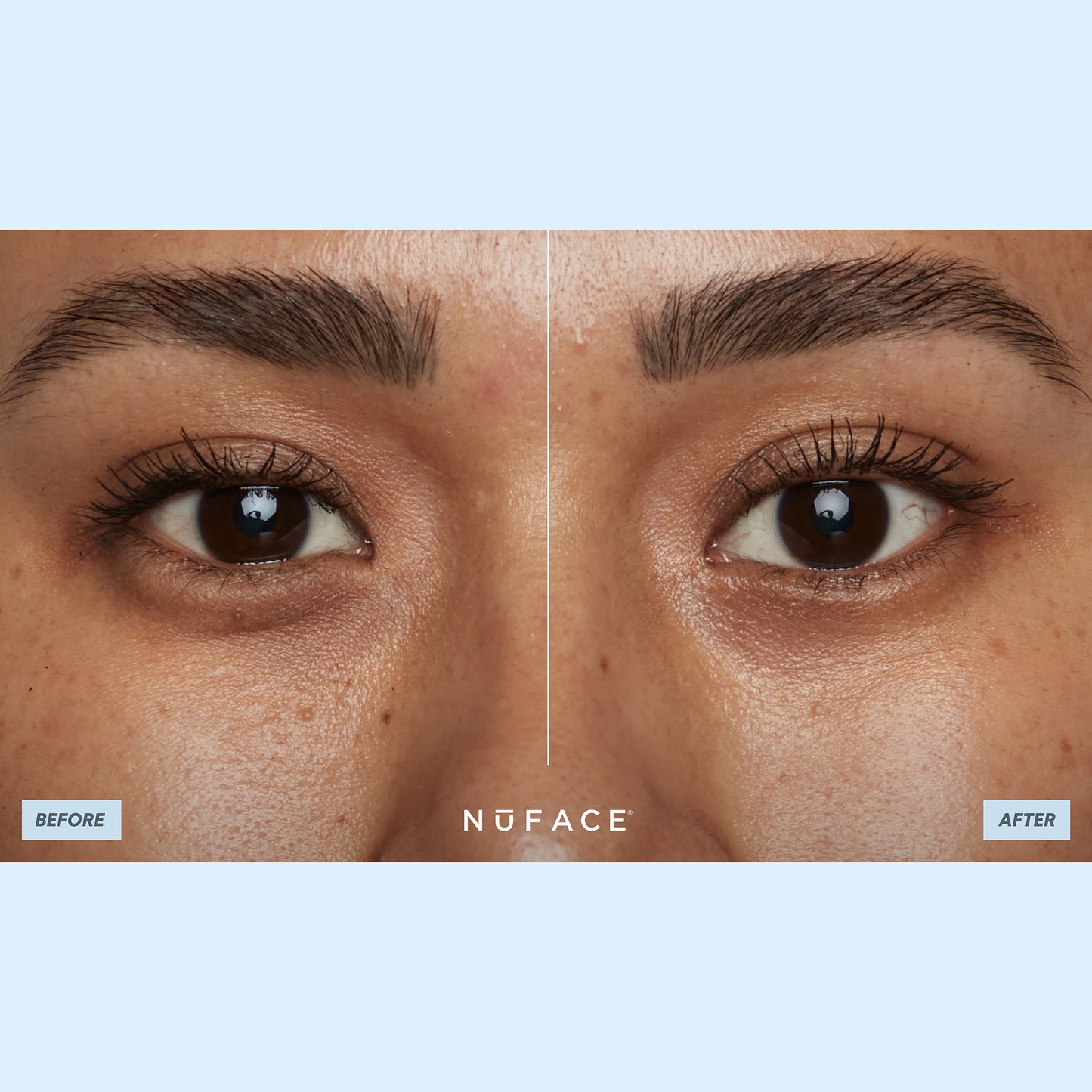 Ionplex Hydra-Gel Eye Mask