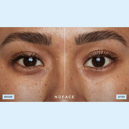 Ionplex Hydra-Gel Eye Mask