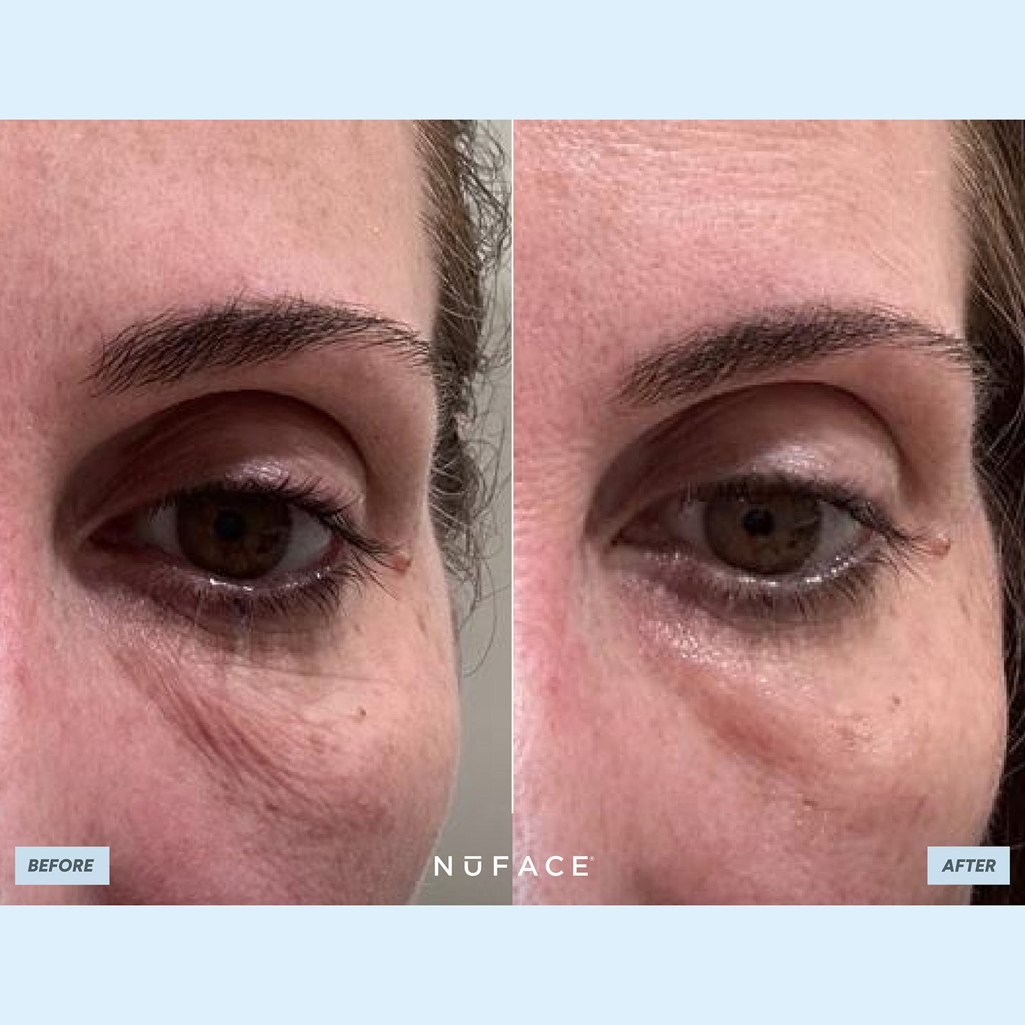 Ionplex Hydra-Gel Eye Mask