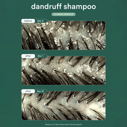 Dandruff Shampoo