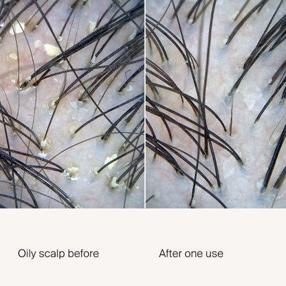 Scalp Care Exfoliator